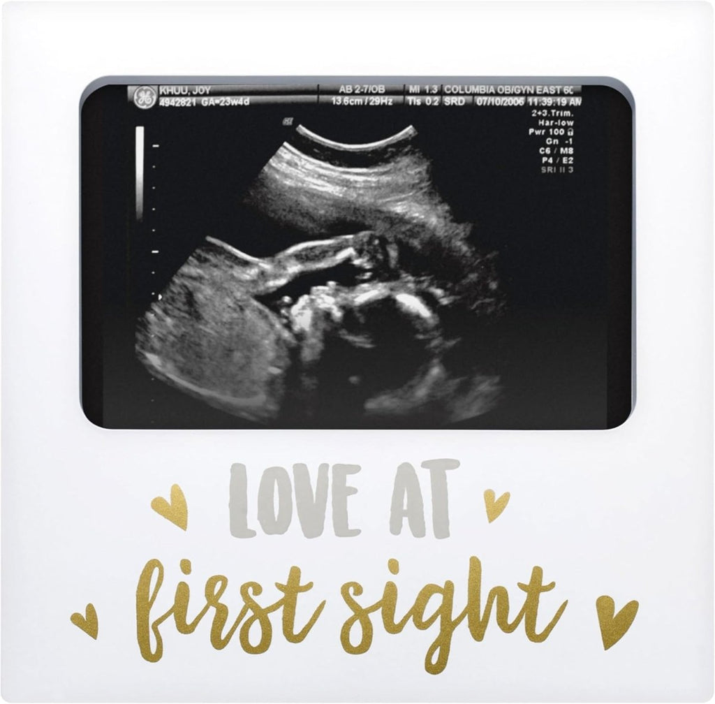 Tiny Ideas Sonogram Signature Frame Guest Book, Perfect for any Baby Registry, Marker Included For Guests to Leave Well - Wishes– Great for Celebrating Baby Showers or Birthdays, White - LittleTreasures