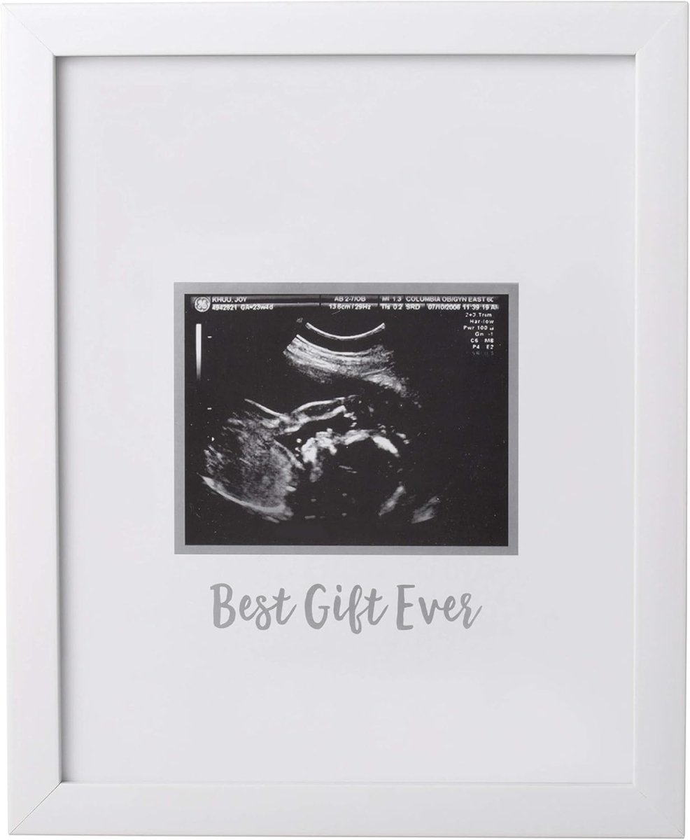 Tiny Ideas Sonogram Signature Frame Guest Book, Perfect for any Baby Registry, Marker Included For Guests to Leave Well - Wishes– Great for Celebrating Baby Showers or Birthdays, White - LittleTreasures