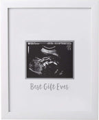 Tiny Ideas Sonogram Signature Frame Guest Book, Perfect for any Baby Registry, Marker Included For Guests to Leave Well - Wishes– Great for Celebrating Baby Showers or Birthdays, White - LittleTreasures
